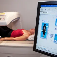 Ile kosztuje badanie na osteoporozę? Ceny, które warto znać