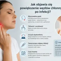 Kobieta dotyka szyi, gdzie widoczne jest zaczerwienienie, wskazujące na powiększone węzły chłonne. Obraz opisuje objawy infekcji.