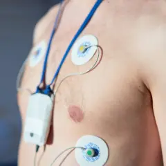 Pacjent z przyklejonymi elektrodami i urządzeniem do monitorowania pracy serca. To jest holter ciśnieniowy, który rejestruje dane przez 24 godziny.