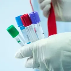 Czy badania hormonalne są na NFZ? Sprawdź, co musisz wiedzieć