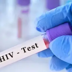 Ile kosztuje test na HIV w laboratorium? Ceny w różnych miastach
