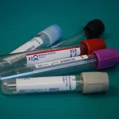 Do czego służy probówka w laboratorium chemicznym – kluczowe zastosowania