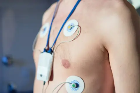 Pacjent z przyklejonymi elektrodami i urządzeniem do monitorowania pracy serca. To jest holter ciśnieniowy, który rejestruje dane przez 24 godziny.