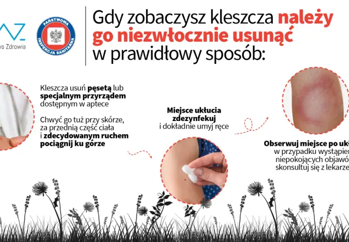 Jak zapobiec boreliozie: skuteczne sposoby na uniknięcie kleszczy