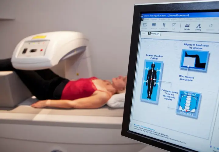 Ile kosztuje badanie na osteoporozę? Ceny, które warto znać