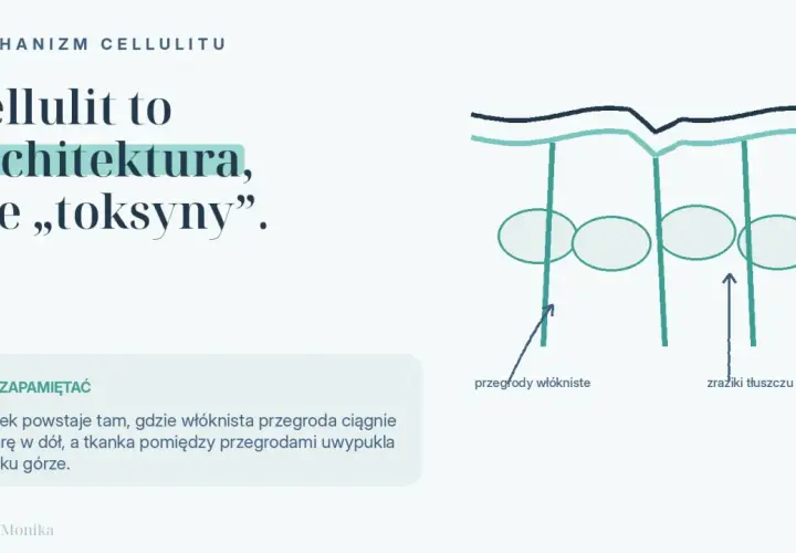Mechanizm cellulitu: włókniste przegrody ciągną skórę, tworząc nierówności. Zrozumienie tego pomoże Ci jak pozbyć się cellulitu.