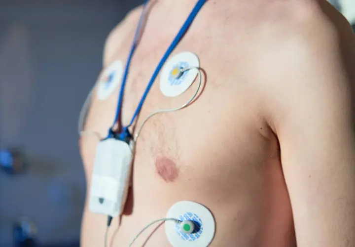 Pacjent z przyklejonymi elektrodami i urządzeniem do monitorowania pracy serca. To jest holter ciśnieniowy, który rejestruje dane przez 24 godziny.