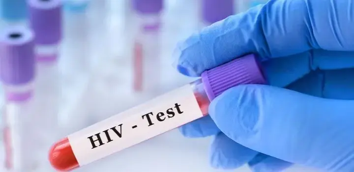 Ile kosztuje test na HIV w laboratorium? Ceny w różnych miastach