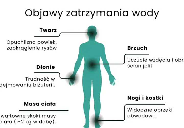Objawy zatrzymania wody: opuchlizna twarzy, dłoni, brzucha, nóg i kostek, nagłe skoki masy ciała. Dowiedz się, jak pozbyć się wody z organizmu.