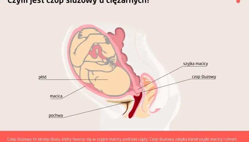 Schemat przedstawia płód w macicy, szyjkę macicy i czop śluzowy zamykający jej kanał, chroniący przed infekcjami.