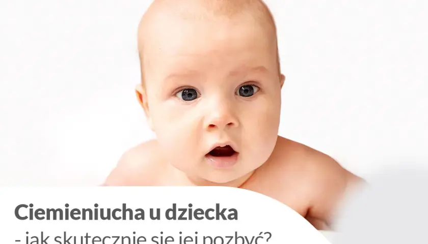 Urocze niemowlę z zaciekawioną miną. Tekst informuje o ciemieniuchy u dziecka i sposobach jej usuwania.