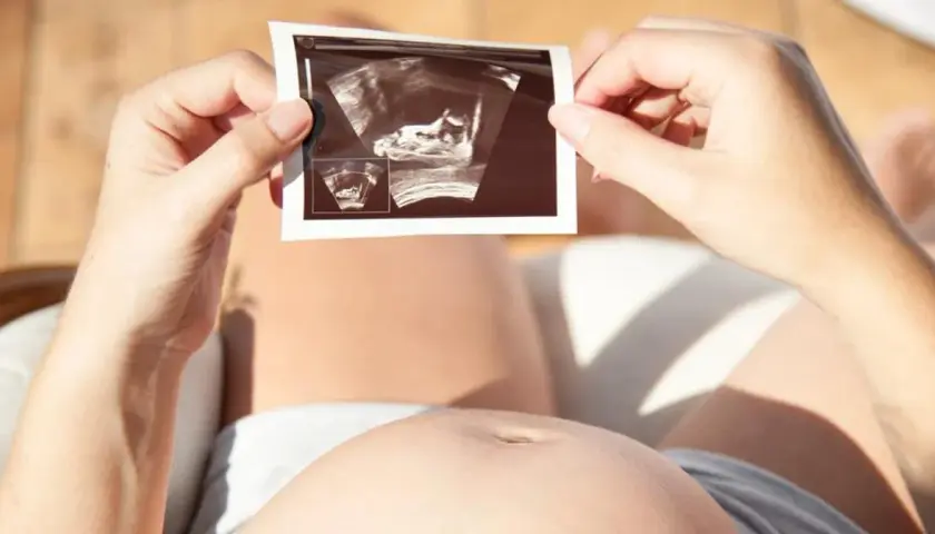 Kobieta trzyma zdjęcie USG, na którym widać zarodek. To nie lewatywa, a cud życia.