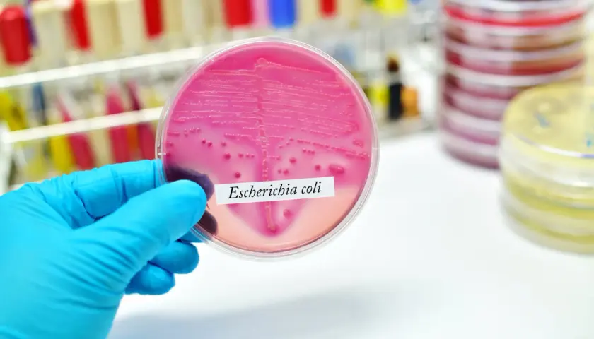 Ręka w niebieskiej rękawiczce trzyma szalkę Petriego z różową pożywką, na której widoczne są kolonie bakterii Escherichia coli.