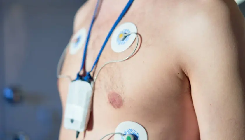 Pacjent z przyklejonymi elektrodami i urządzeniem do monitorowania pracy serca. To jest holter ciśnieniowy, który rejestruje dane przez 24 godziny.