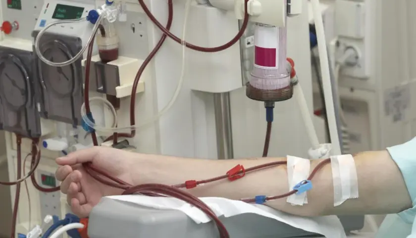 Ramię pacjenta podłączone do maszyny do dializy. Czerwone wężyki prowadzą krew do aparatu, który oczyszcza ją z toksyn.