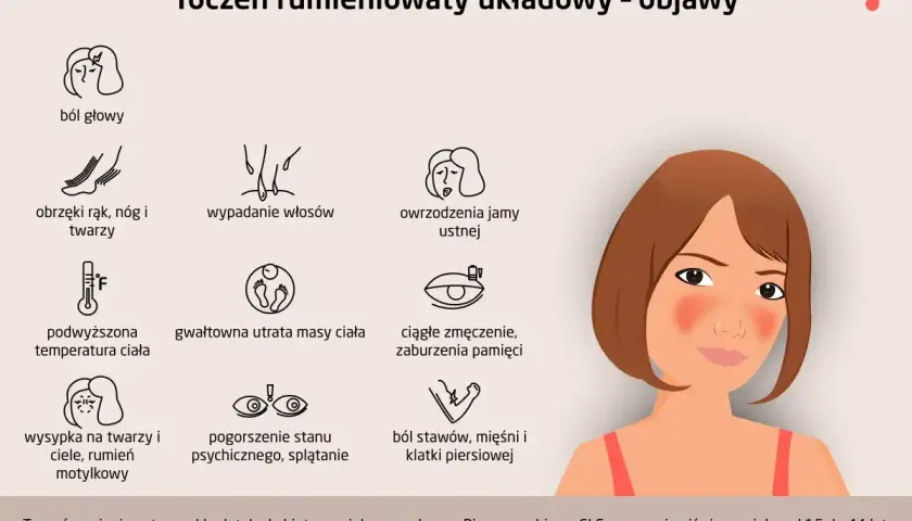 Pierwsze objawy tocznia: ból głowy, wysypka motylkowa, obrzęki, wypadanie włosów, owrzodzenia jamy ustnej, gorączka, utrata masy ciała, zmęczenie, problemy z pamięcią, pogorszenie nastroju, bóle stawów i mięśni.