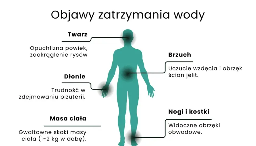 Objawy zatrzymania wody: opuchlizna twarzy, dłoni, brzucha, nóg i kostek, nagłe skoki masy ciała. Dowiedz się, jak pozbyć się wody z organizmu.