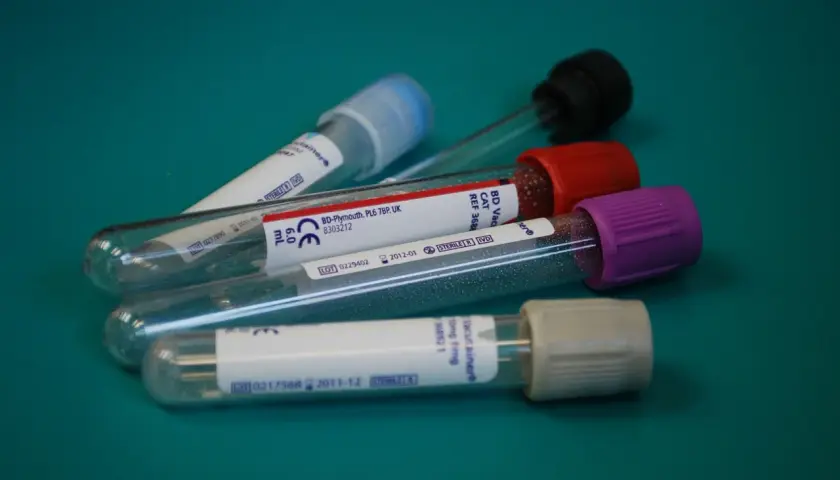 Do czego służy probówka w laboratorium chemicznym – kluczowe zastosowania
