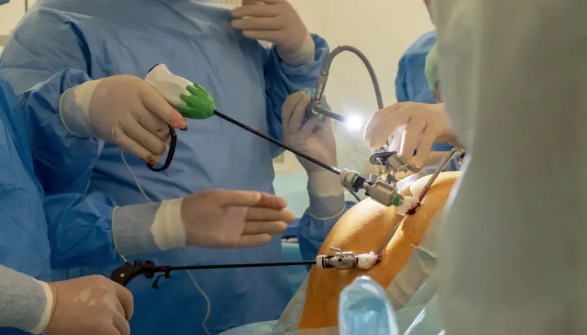 Chirurdzy w rękawiczkach i fartuchach przeprowadzają laparoskopię, używając narzędzi do precyzyjnej operacji.