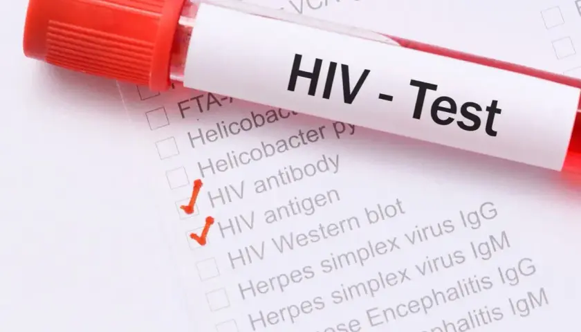 Probówka z krwią do testu na HIV. Zaznaczone "HIV antibody" i "HIV antigen".