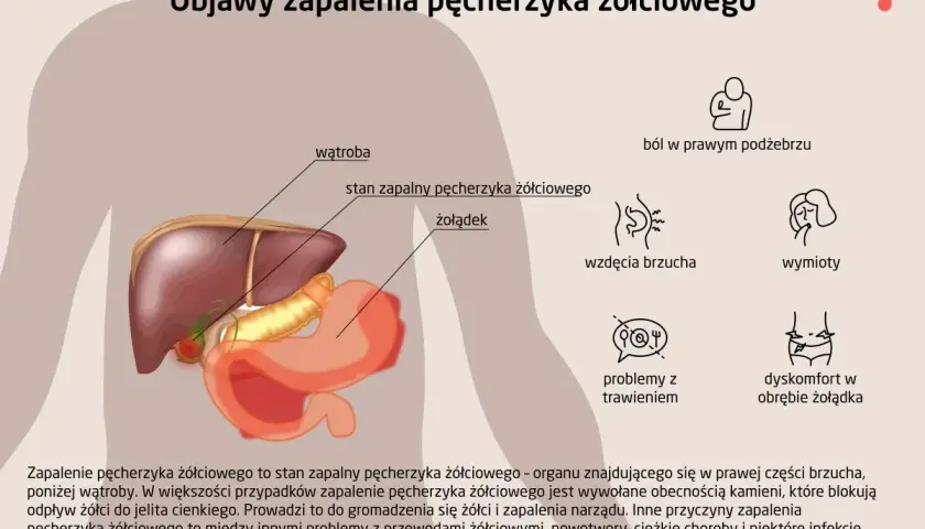 Objawy zapalenia pęcherzyka żółciowego: ból w prawym podżebrzu, wzdęcia, wymioty, problemy z trawieniem, dyskomfort w żołądku.