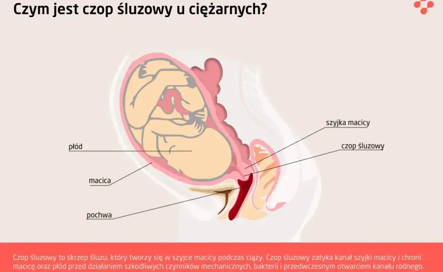 Czop śluzowy w ciąży - Kiedy to alarm, a kiedy norma?