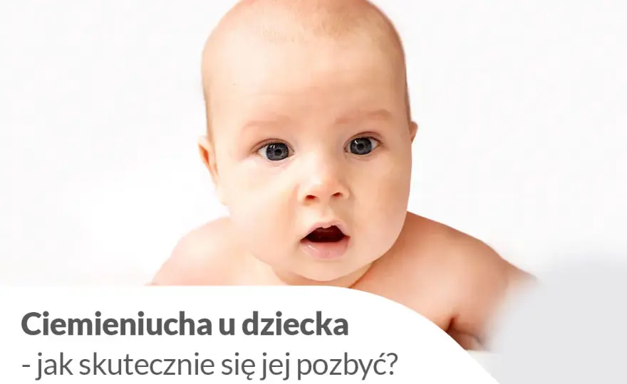 Ciemieniucha u niemowląt - kiedy do lekarza? Poradnik
