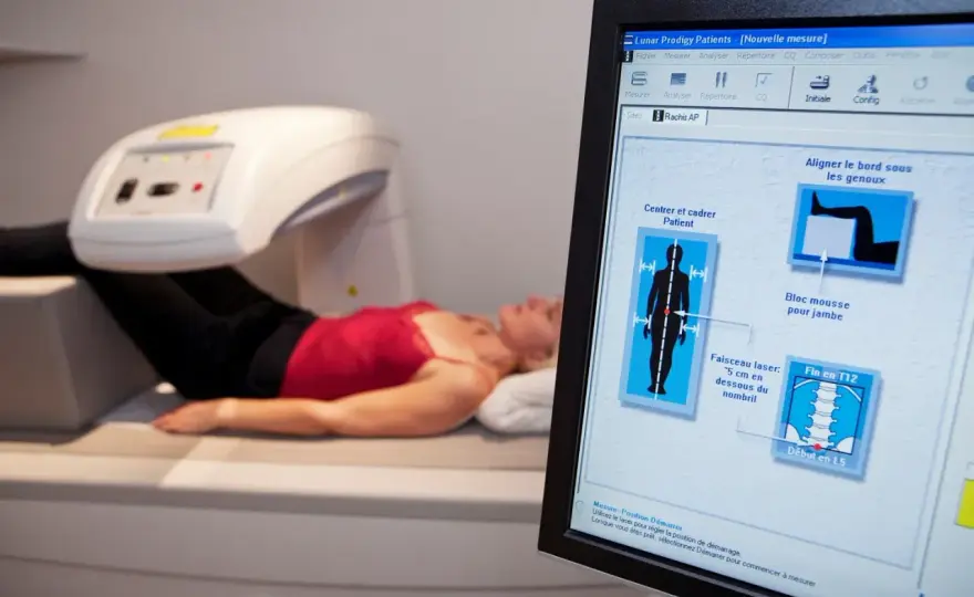 Ile kosztuje badanie na osteoporozę? Ceny, które warto znać
