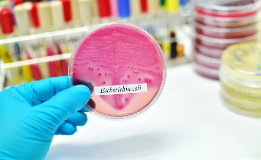 E. coli - choroby, objawy i kiedy pilnie skonsultować się z lekarzem