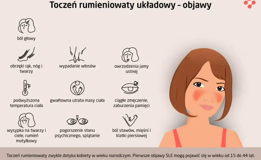Pierwsze objawy tocznia rumieniowatego - Nie przegap tych sygnałów!