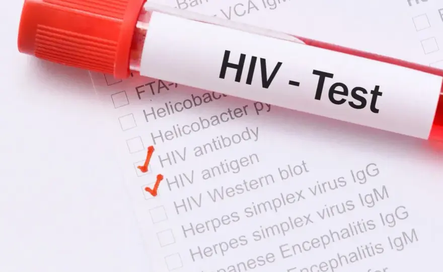 Badanie HIV - kiedy zrobić, jaki test wybrać i gdzie się zbadać