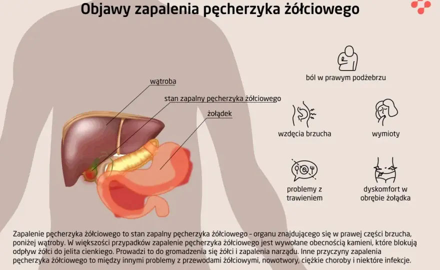 Ból w prawym podżebrzu - kiedy winny jest pęcherzyk żółciowy?