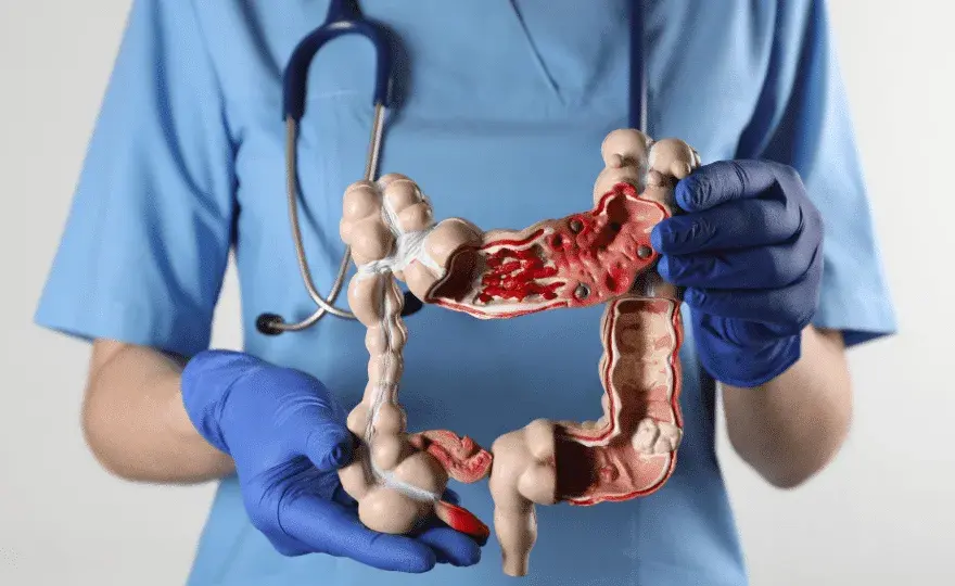Czy rak jelita wyjdzie w badaniu krwi? Prawda o diagnozie nowotworu