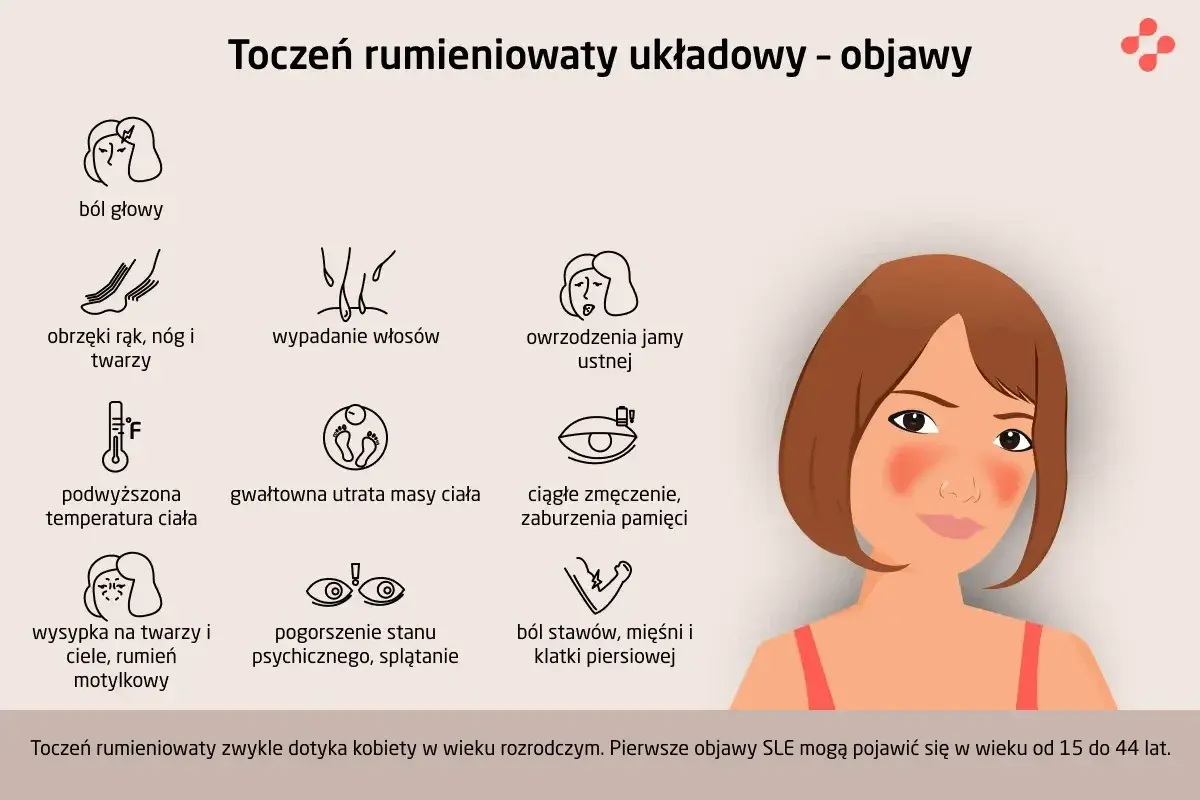 Pierwsze objawy tocznia: ból głowy, wysypka motylkowa, obrzęki, wypadanie włosów, owrzodzenia jamy ustnej, gorączka, utrata masy ciała, zmęczenie, problemy z pamięcią, pogorszenie nastroju, bóle stawów i mięśni.