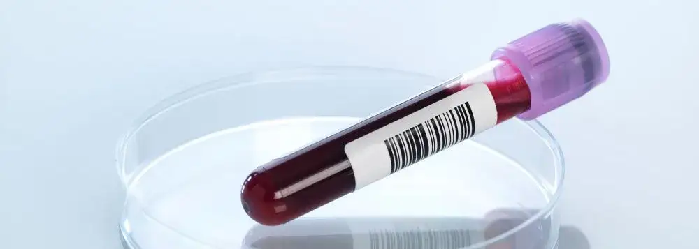 Zdjęcie Jakie badania na niedobory witamin pomogą uniknąć problemów zdrowotnych