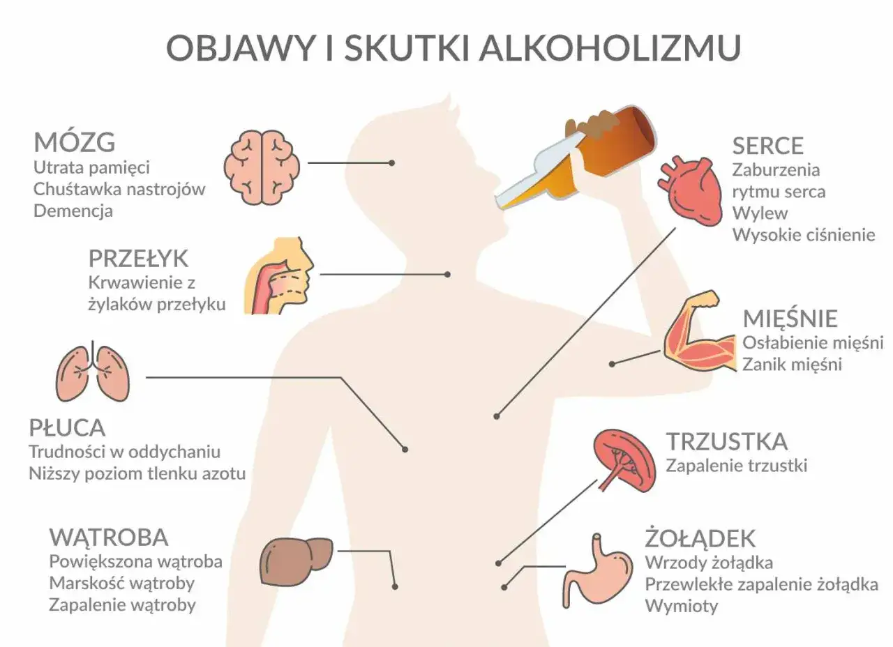 Zdjęcie Czy alkohol niszczy mózg? Sprawdź, jakie są skutki dla zdrowia